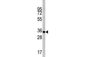 Western blot analysis of Caspase-6 antibody and mouse liver tissue lysate