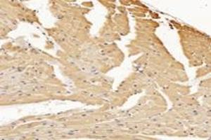 Immunohistochemistry analysis of paraffin-embedded mouse heart using,RHOBTB3 (ABIN7075422) at dilution of 1: 3600 (RHOBTB3 anticorps)