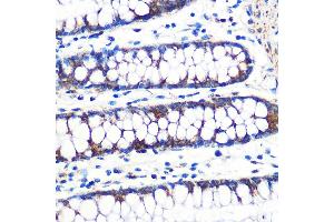 Immunohistochemistry of paraffin-embedded human colon using TFAM Rabbit mAb (ABIN3023684, ABIN3023685, ABIN3023686, ABIN1680049 and ABIN1680050) at dilution of 1:100 (40x lens). (TFAM anticorps)