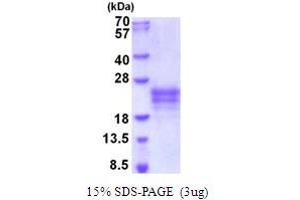 SDS-PAGE (SDS) image for Interleukin 9 (IL9) (AA 19-144) protein (His tag) (ABIN5854076)