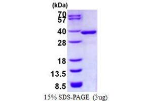 Image no. 1 for NmrA-Like Family Domain Containing 1 (NMRAL1) protein (His tag) (ABIN1098305) (NMRAL1 Protein (His tag))