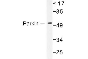 Image no. 1 for anti-Parkinson Protein 2, E3 Ubiquitin Protein Ligase (Parkin) (PARK2) antibody (ABIN271775) (Parkin anticorps)