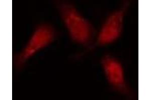 ABIN6276417 staining  HeLa cells by IF/ICC. (JUP anticorps  (C-Term))