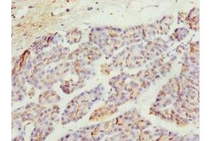 Immunohistochemistry of paraffin-embedded human pancreatic tissue using ABIN7174959 at dilution of 1:100 (MYO5C anticorps  (AA 270-420))