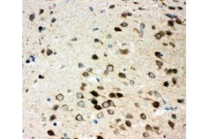 IHC-P: Integrin alpha 3 antibody testing of rat brain tissue
