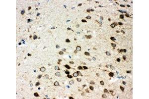 IHC-P: Integrin alpha 3 antibody testing of rat brain tissue (ITGA3 anticorps  (N-Term))