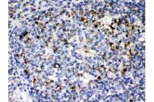 GC1q R was detected in paraffin-embedded sections of human tonsil tissues using rabbit anti- GC1q R Antigen Affinity purified polyclonal antibody (Catalog # ) at 1 ?