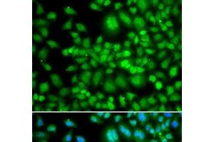 Immunofluorescence analysis of MCF-7 cells using SETD5 Polyclonal Antibody (SETD5 anticorps)