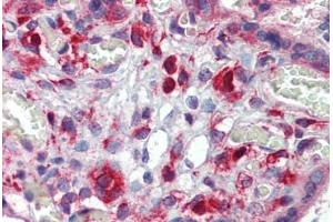 Human Placenta: Formalin-Fixed, Paraffin-Embedded (FFPE)