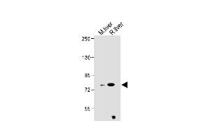All lanes : Anti-ZBT24 Antibody (N-term) at 1:1000 dilution Lane 1: Mouse liver lysate Lane 2: Rat liver lysate Lysates/proteins at 20 μg per lane.