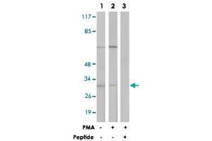 Western blot analysis of extracts from LoVo cells (Lane 1) and Jurkat cells (Lane 2 and 3) treated with PMA (125 ng/mL, 30 min), using MARCKS polyclonal antibody . (MARCKS anticorps  (Ser162.))