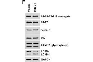 Effect of autophagy on miR-21-induced drug resistance.