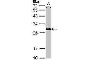 WB Image Sample (30 ug of whole cell lysate) A: NIH-3T3 12% SDS PAGE VAPA antibody antibody diluted at 1:1000 (VAPA anticorps)