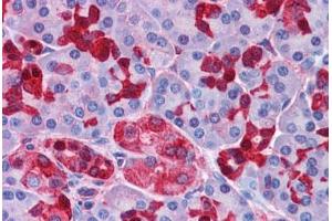 Human Pancreas: Formalin-Fixed, Paraffin-Embedded (FFPE)