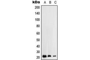 Western blot analysis of RhoH expression in HEK293T (A), HepG2 (B), Jurkat (C) whole cell lysates.