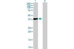 Western Blot analysis of NKX2-5 expression in transfected 293T cell line by NKX2-5 MaxPab polyclonal antibody. (NK2 Homeobox 5 anticorps  (AA 1-324))