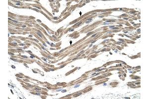 C1QB antibody was used for immunohistochemistry at a concentration of 4-8 ug/ml to stain Skeletal muscle cells (arrows) in Human Muscle.