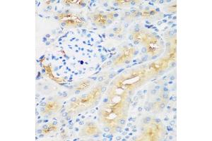 Immunohistochemistry of paraffin-embedded rat kidney using PROCR antibody (ABIN6291490) at dilution of 1:200 (40x lens). (PROCR anticorps)