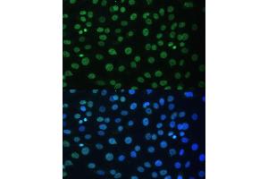 Immunofluorescence analysis of C6 cells using HNRNPD antibody (ABIN7267632) at dilution of 1:100.