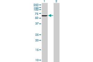 Western Blot analysis of CES2 expression in transfected 293T cell line by CES2 MaxPab polyclonal antibody.