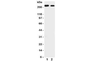 Western blot testing of Tuberin antibody and Lane 1:  rat liver