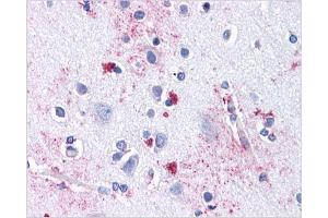 Immunohistochemical staining of Brain Cortex using AP31144PU-N SLC29A1 antibody (SLC29A1 anticorps  (Internal Region))