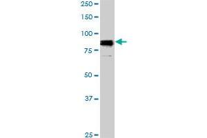 SP1 monoclonal antibody (M01), clone 4H6.