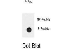 Image no. 1 for anti-Adrenergic, beta-2-, Receptor, Surface (ADRB2) (pSer261) antibody (ABIN358476) (beta 2 Adrenergic Receptor anticorps  (pSer261))