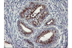 Image no. 4 for anti-Golgi Membrane Protein 1 (GOLM1) antibody (ABIN1498497) (GOLM1 anticorps)