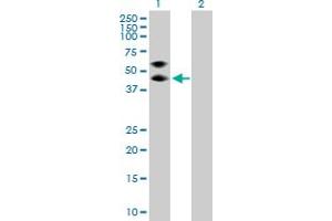 Western Blot analysis of SERPINA3 expression in transfected 293T cell line by SERPINA3 MaxPab polyclonal antibody. (SERPINA3 anticorps  (AA 1-423))