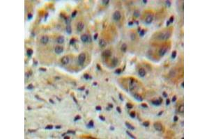 Used in DAB staining on fromalin fixed paraffin-embedded Liver tissue (SERPINA10 anticorps  (AA 6-125))