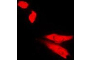 anti-Topoisomerase (DNA) II beta 180kDa (TOP2B) (N-Term) antibody