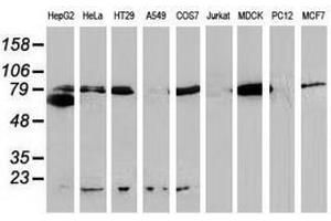 Image no. 11 for anti-Catenin (Cadherin-Associated Protein), beta 1, 88kDa (CTNNB1) antibody (ABIN1496888)