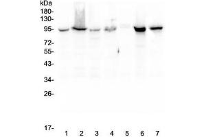 Western blot testing of human 1) HeLa, 2) COLO-320, 3) HepG2, 4) MCF7, 5) SW620, 6) 22RV1 and 7) Jurkat lysate with Beta Catenin antibody.
