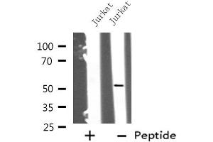 Western blot analysis of KRT12 using Jurkat whole cell lysates (KRT12 anticorps  (Internal Region))