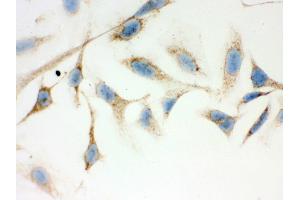 IHC analysis of ERAB using anti-ERAB antibody .