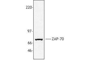 Image no. 1 for anti-zeta-Chain (TCR) Associated Protein Kinase 70kDa (ZAP70) (AA 282-307) antibody (ABIN205364) (ZAP70 anticorps  (AA 282-307))