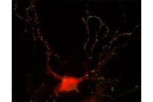Indirect immunostaining of hippocampus neurons with anti-GABA-A receptor α3 (dilution 1 : 500; red) and mouse anti-Synapsin 1 (cat.
