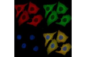 c-Met Mouse Monoclonal Antibody staining HepG2 cells by IF/ICC.