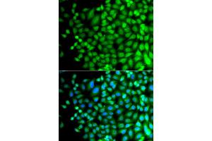 Immunofluorescence analysis of A549 cells using SUPT20H antibody. (FAM48A/P38IP anticorps)