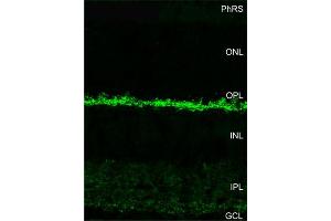 Indirect immunostaining of ribbon synapses in the outer plexiform layer of the mouse retina (dilution 1 : 200).