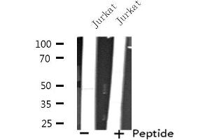 Western blot analysis of extracts from Jurkat cells, using TEAD3 antibody. (TEAD3 anticorps  (Internal Region))
