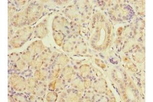 Immunohistochemistry of paraffin-embedded human pancreatic tissue using ABIN7171606 at dilution of 1:100 (TBC1D19 anticorps  (AA 1-300))