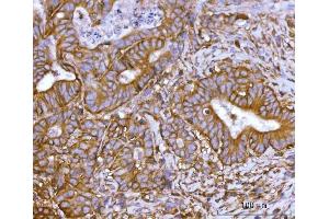 IHC analysis of SNAP23 using anti-SNAP23 antibody (ABIN7599089). (SNAP23 anticorps  (AA 1-211))