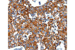 Immunohistochemistry (IHC) image for anti-Kallikrein 2 (KLK2) antibody (ABIN1873440) (Kallikrein 2 anticorps)