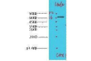 Western Blotting (WB) image for anti-Cytochrome C Oxidase Subunit I (COX1) antibody (ABIN3181265) (COX1 anticorps)