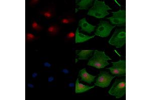ABIN7094503 and ABIN7098552 staining  cells by IF/ICC.