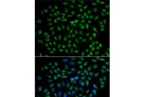 Immunofluorescence analysis of U2OS cells using RBPJ Polyclonal Antibody (RBPJ anticorps)
