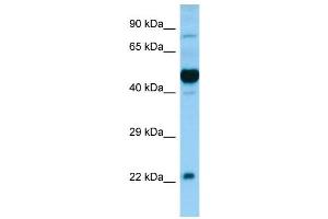 WB Suggested Anti-HCRTR1 Antibody Titration: 0. (HCRTR1 anticorps  (N-Term))