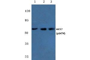 Western blot (WB) analysis of p-AKT2 antibody at 1/500 dilution (AKT2 anticorps  (pSer474))
